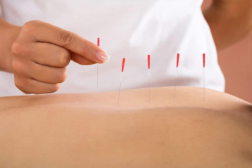 acupuntura clinicabayon 4 1000