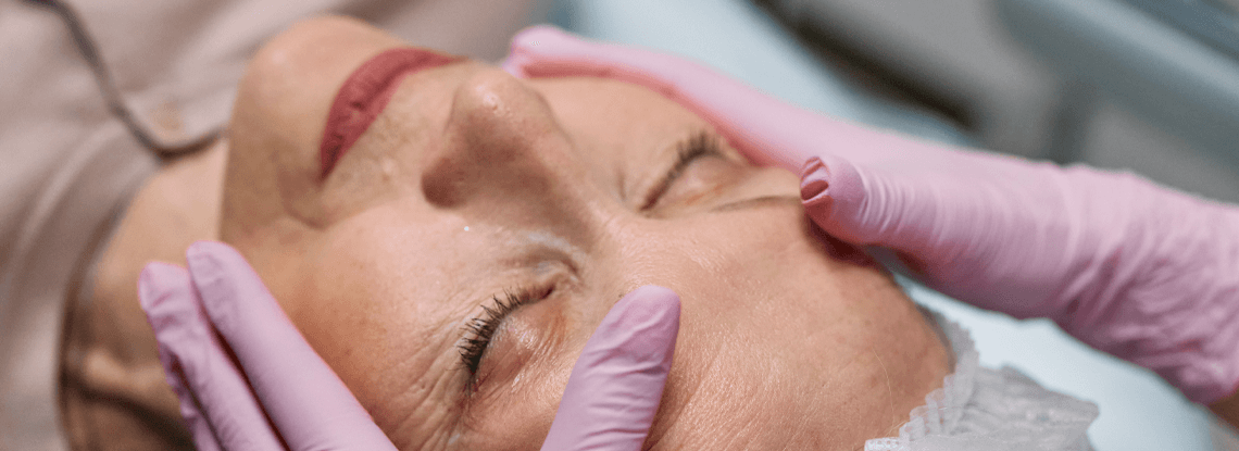 mesoterapia facial madrid
