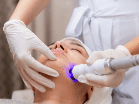 ipl facial madrid