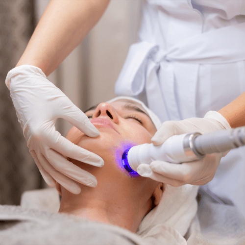 ipl facial madrid