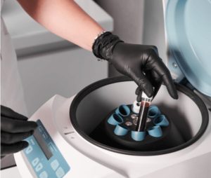 bioestimuladores clinica bayon madrid