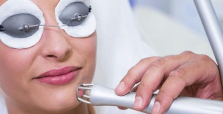 laser co2 clinica bayon madrid