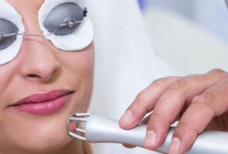 laser co2 clinica bayon madrid