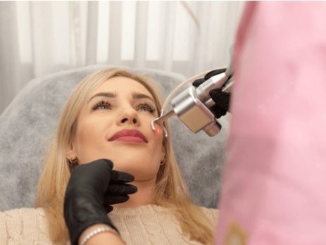 laser co2 clinica bayon madrid