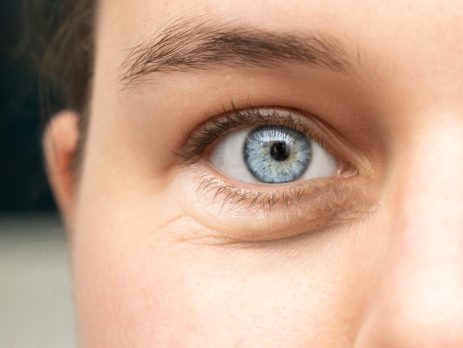 blefaroplastia clinica bayon madrid