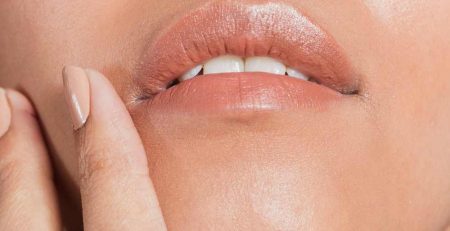 rellenos labiales clinica bayon